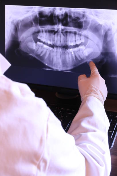 Best Emergency Dental Care for Broken or Chipped Teeth in North Pembroke, MA